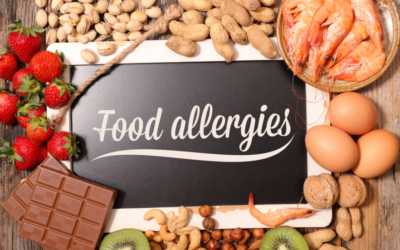 How a Registered Dietitian Can Help You With Food Allergies