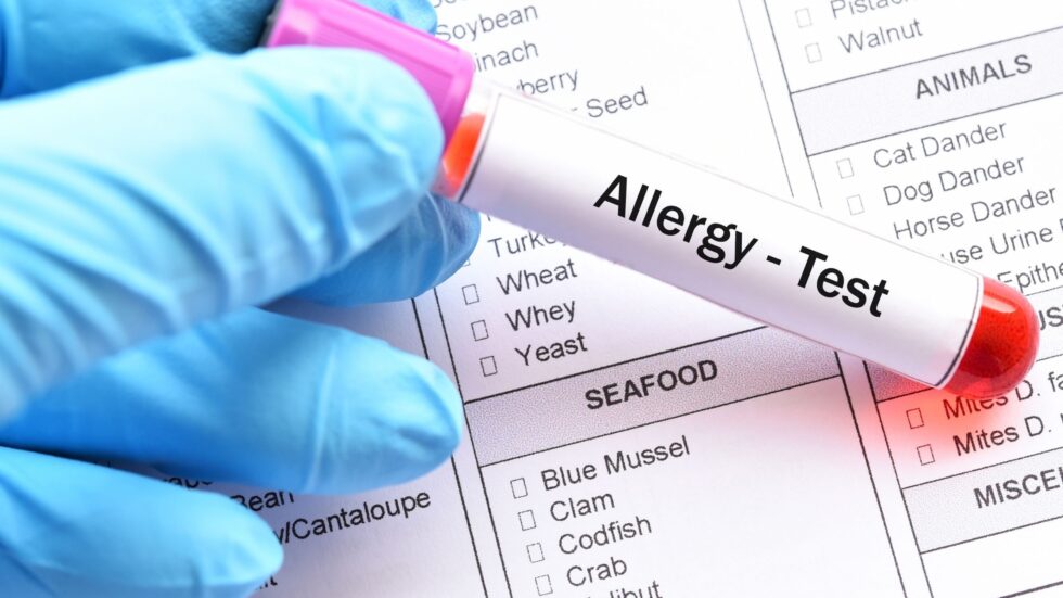 Winnipeg food allergy dietitian